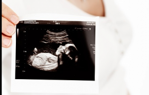 Ultraschall, Schwangerschaft