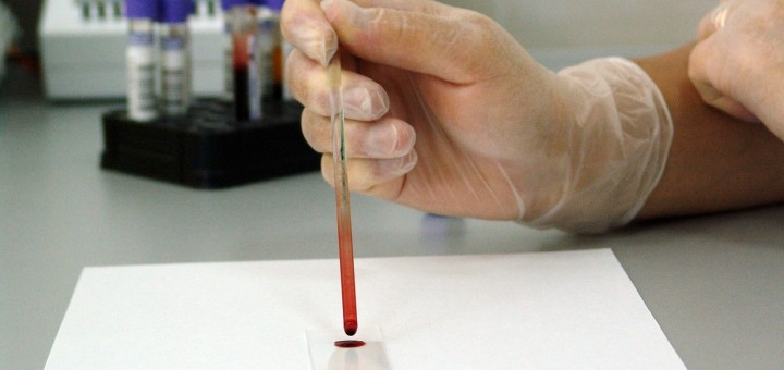 Bluttest im Labor