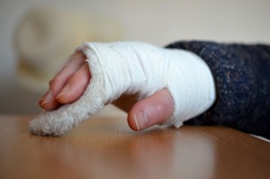 gebrochene Hand